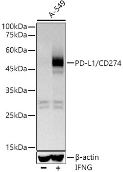 PD-L1/CD274 Rabbit Monoclonal Antibody