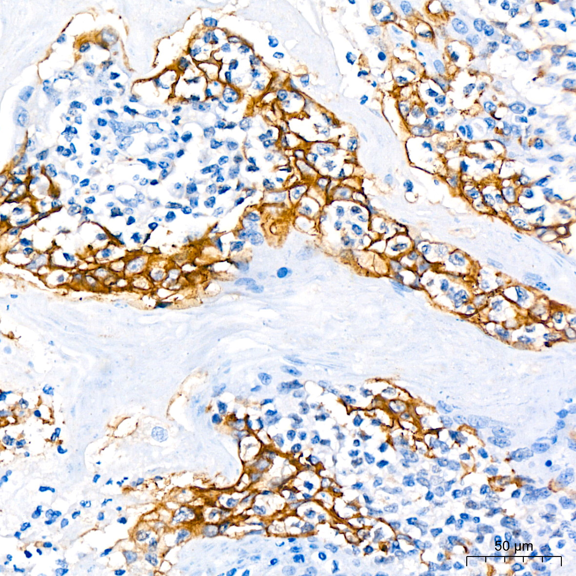 PD-L1/CD274 Rabbit Monoclonal Antibody - Image 3