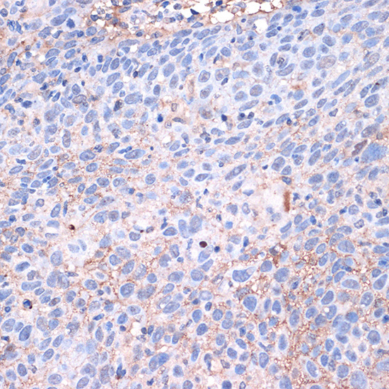 PD-L1/CD274 Rabbit Polyclonal Antibody - Image 3