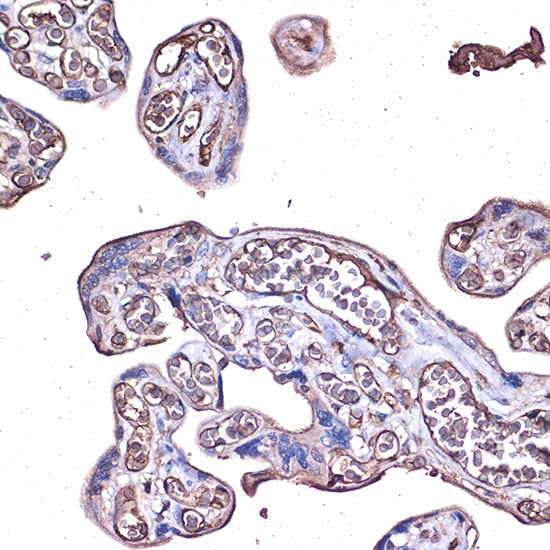 PD-L1/CD274 Rabbit Polyclonal Antibody - Image 4