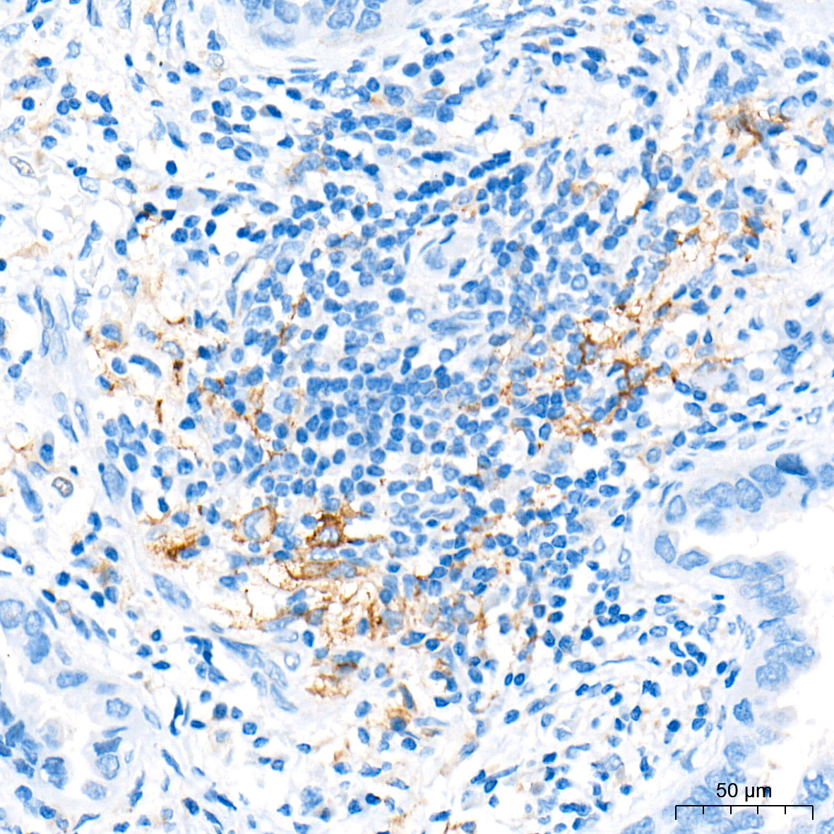 PD-L1/CD274 Rabbit Polyclonal Antibody - Image 3