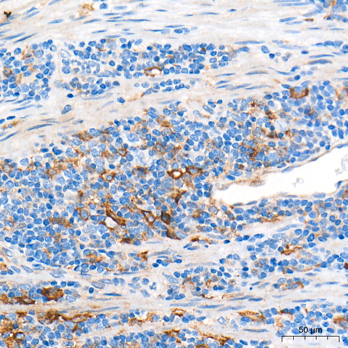PD-L1/CD274 Rabbit Polyclonal Antibody - Image 4