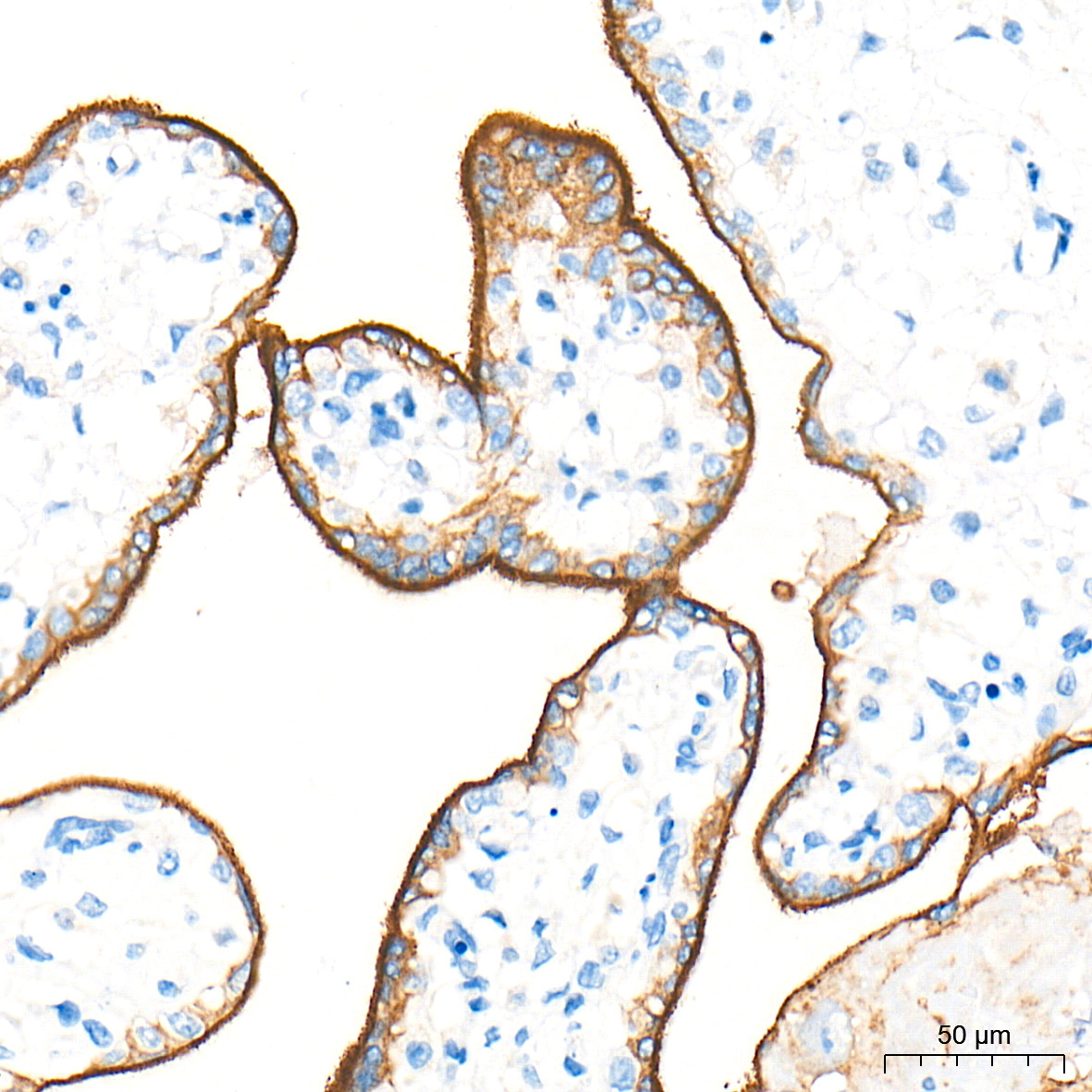 PD-L1/CD274 Rabbit Polyclonal Antibody - Image 6