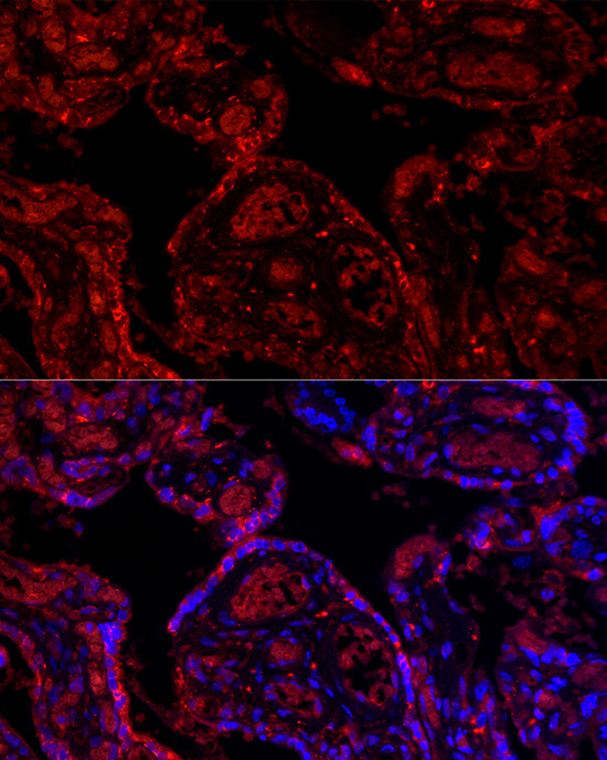 PD-L1/CD274 Rabbit Polyclonal Antibody - Image 7