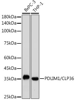 PDLIM1/CLP36 Rabbit Monoclonal Antibody