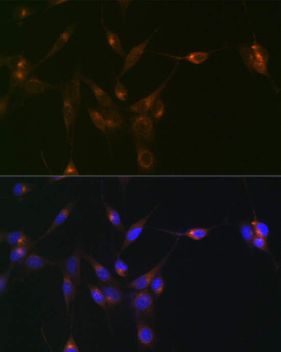 PDLIM1/CLP36 Rabbit Monoclonal Antibody - Image 3