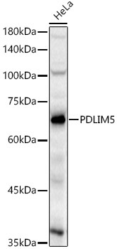 PDLIM5 Rabbit Polyclonal Antibody