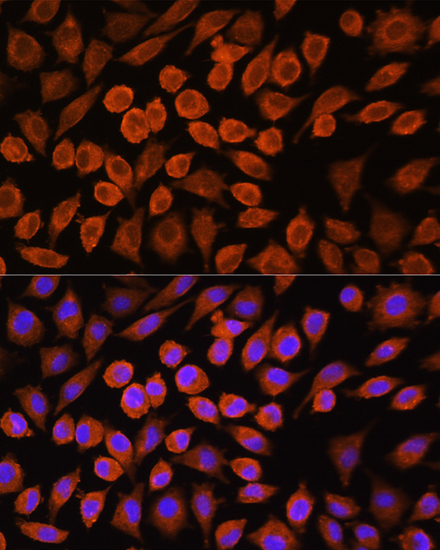 PDP1 Rabbit Polyclonal Antibody - Image 2