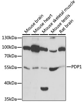 PDP1 Rabbit Polyclonal Antibody