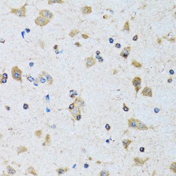 PDP1 Rabbit Polyclonal Antibody - Image 2