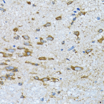 PDP1 Rabbit Polyclonal Antibody - Image 3