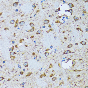 PDP1 Rabbit Polyclonal Antibody - Image 4