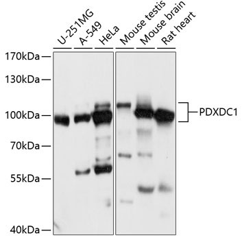 PDXDC1 Rabbit Polyclonal Antibody
