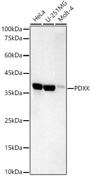 PDXK Rabbit Monoclonal Antibody
