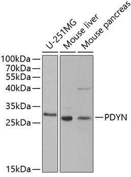 PDYN Rabbit Polyclonal Antibody