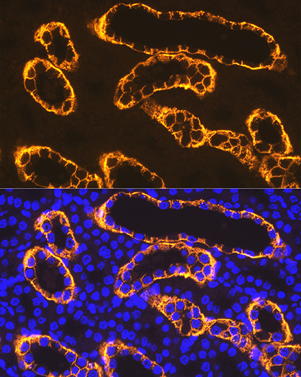 PDZK1 Rabbit Monoclonal Antibody