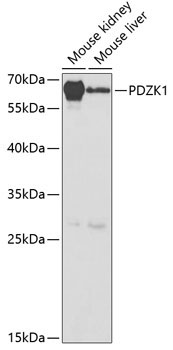 PDZK1 Rabbit Polyclonal Antibody