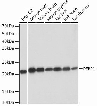 PEBP1 Rabbit Monoclonal Antibody