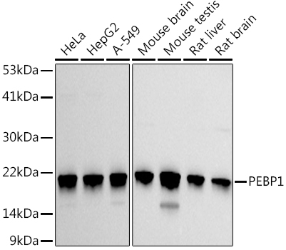 PEBP1 Rabbit Polyclonal Antibody