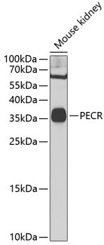 PECR Rabbit Polyclonal Antibody