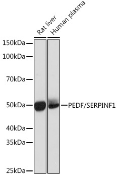 PEDF/SERPINF1 Rabbit Monoclonal Antibody