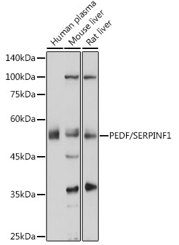 PEDF/SERPINF1 Rabbit Polyclonal Antibody