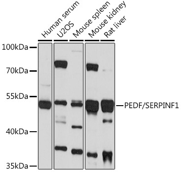 PEDF/SERPINF1 Rabbit Polyclonal Antibody