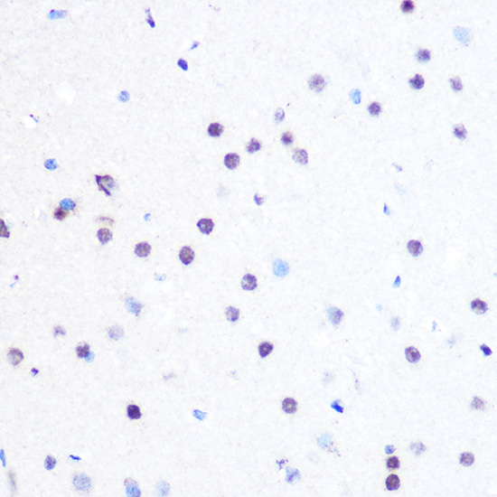 PEG3 Rabbit Polyclonal Antibody - Image 2