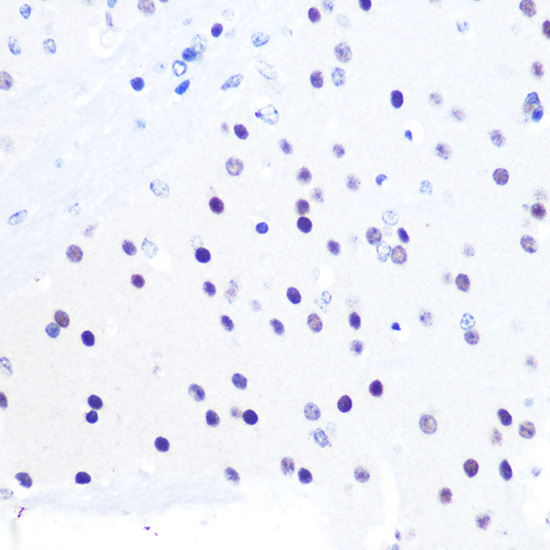 PEG3 Rabbit Polyclonal Antibody - Image 3