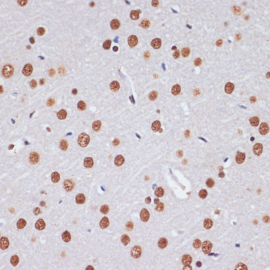 PELP1 Rabbit Polyclonal Antibody