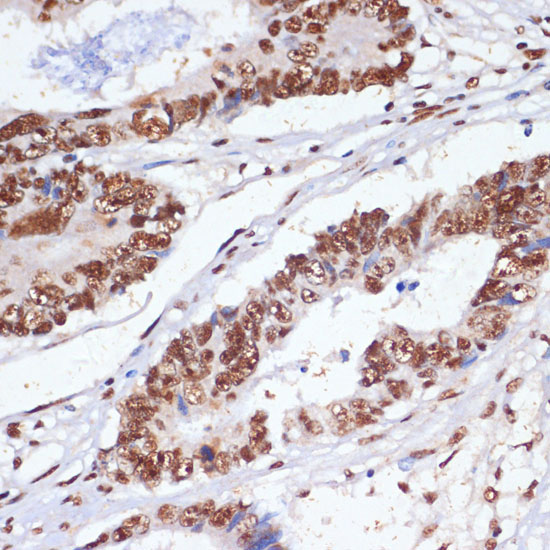 PELP1 Rabbit Polyclonal Antibody - Image 2