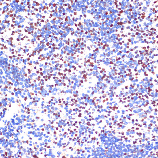 PELP1 Rabbit Polyclonal Antibody - Image 3