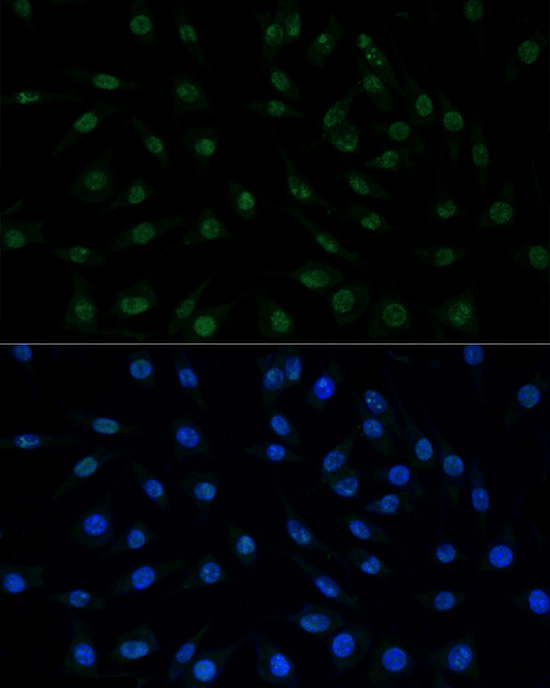PELP1 Rabbit Polyclonal Antibody - Image 2