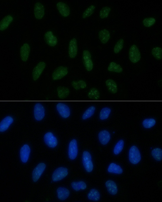 PELP1 Rabbit Polyclonal Antibody - Image 3