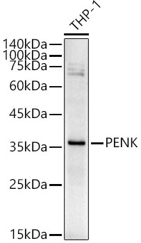 PENK Rabbit Polyclonal Antibody
