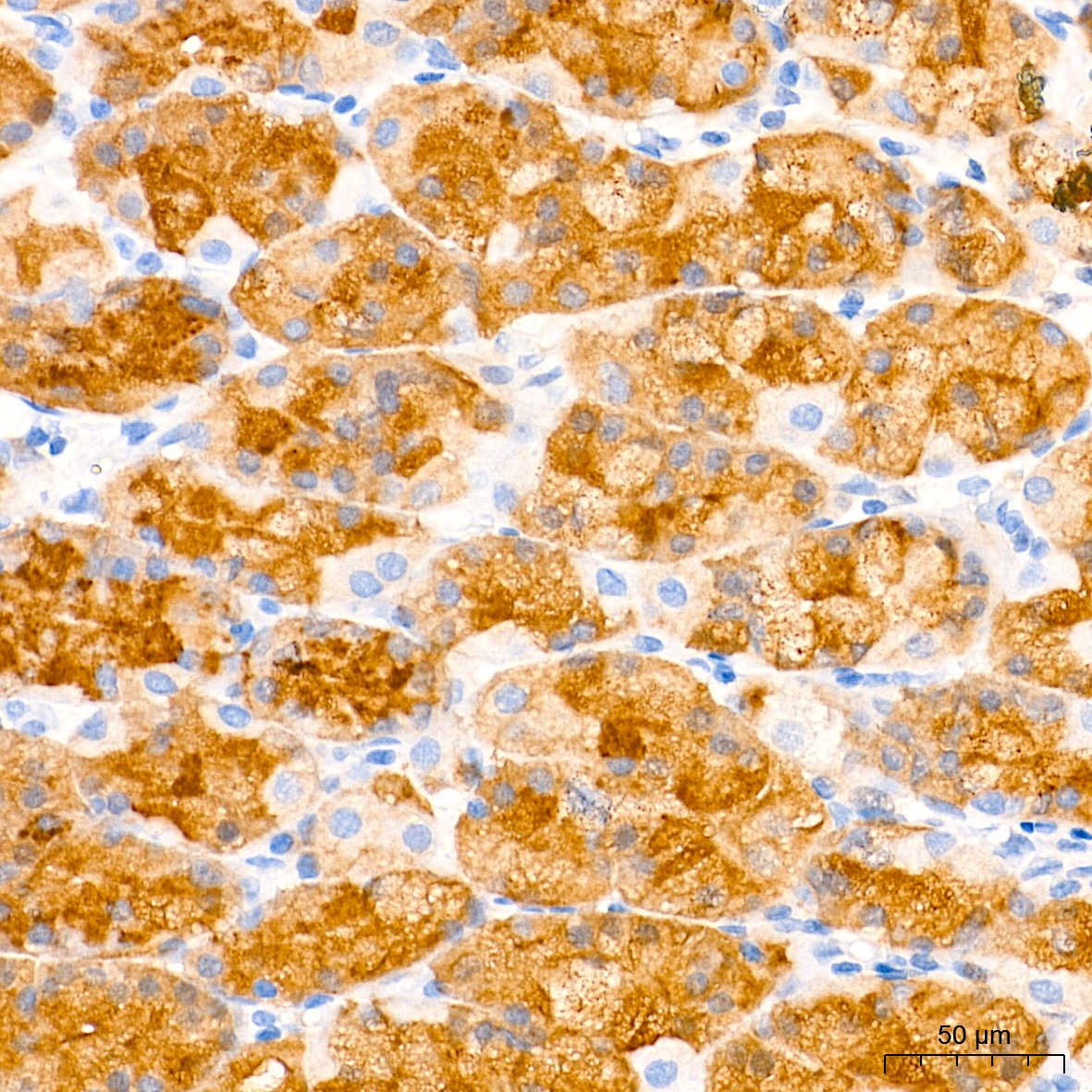 Pepsinogen II (PG II) Rabbit Monoclonal Antibody