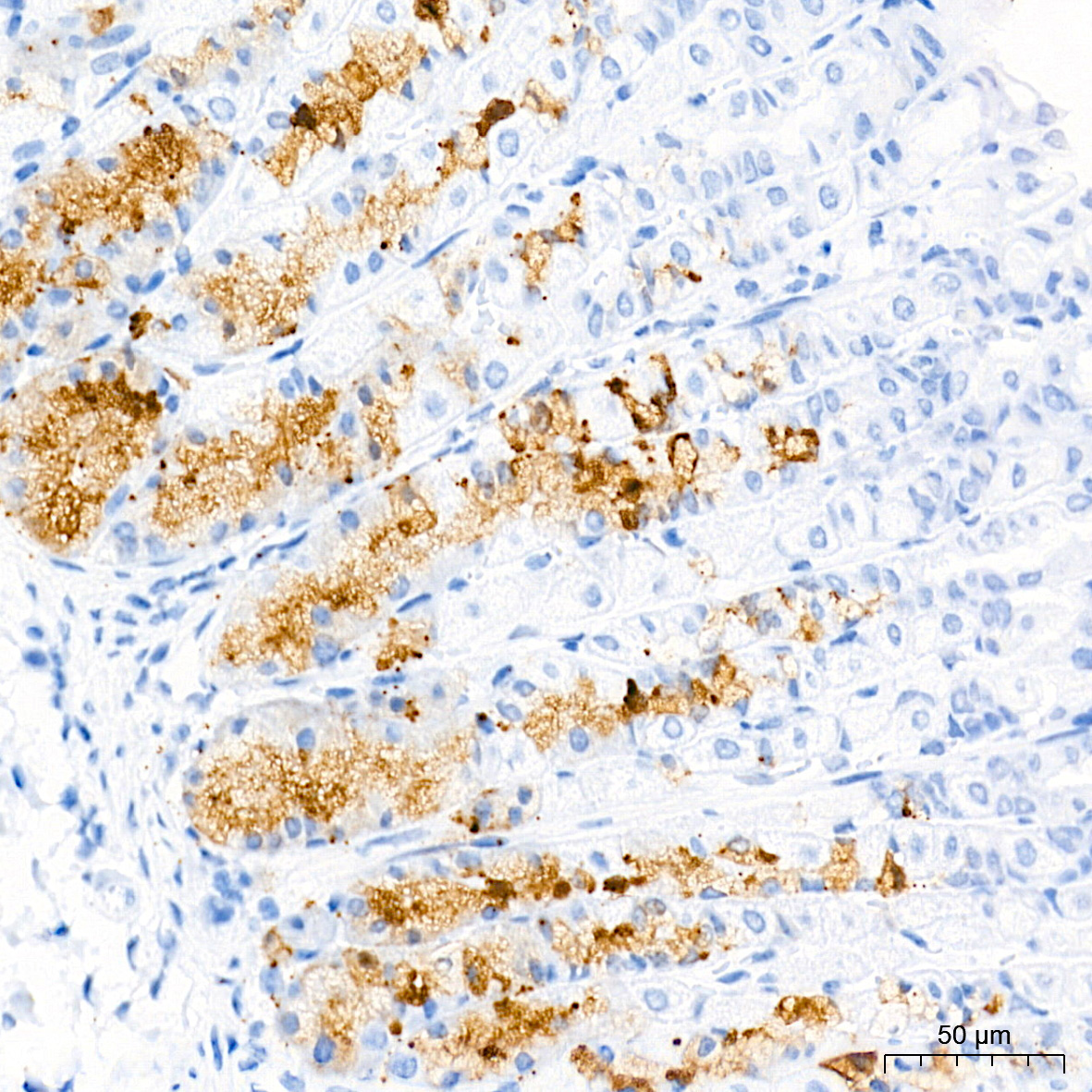 Pepsinogen II (PG II) Rabbit Monoclonal Antibody - Image 2