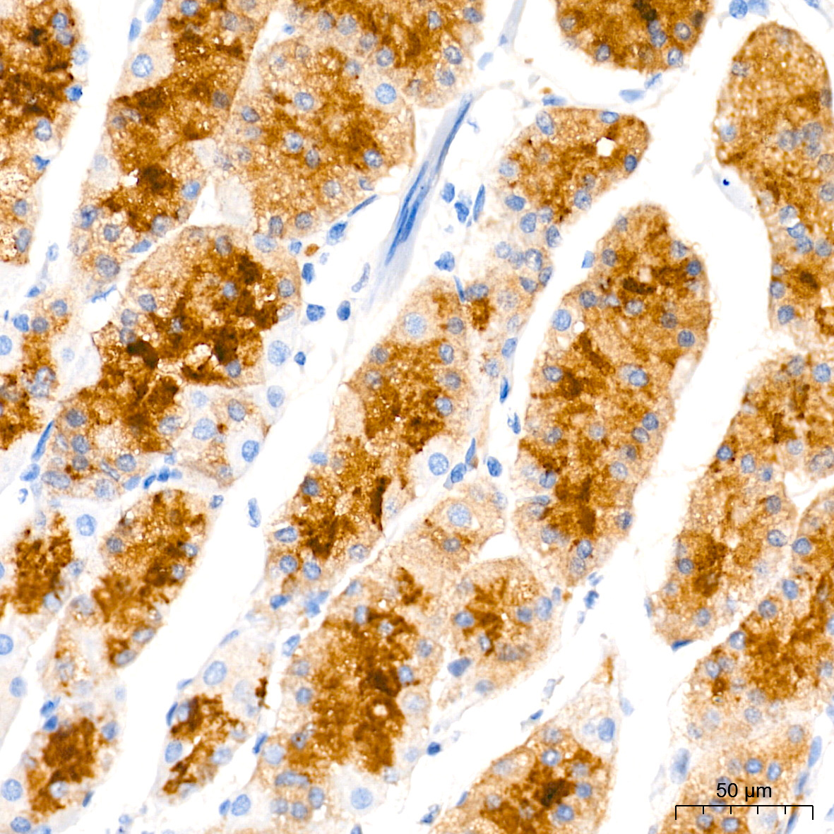 Pepsinogen II (PG II) Rabbit Monoclonal Antibody