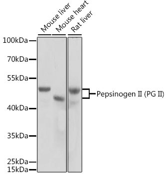 Pepsinogen II (PG II) Rabbit Polyclonal Antibody