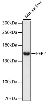 PER2 Rabbit Polyclonal Antibody