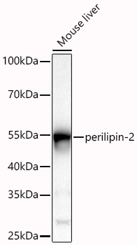 perilipin-2 Rabbit Polyclonal Antibody