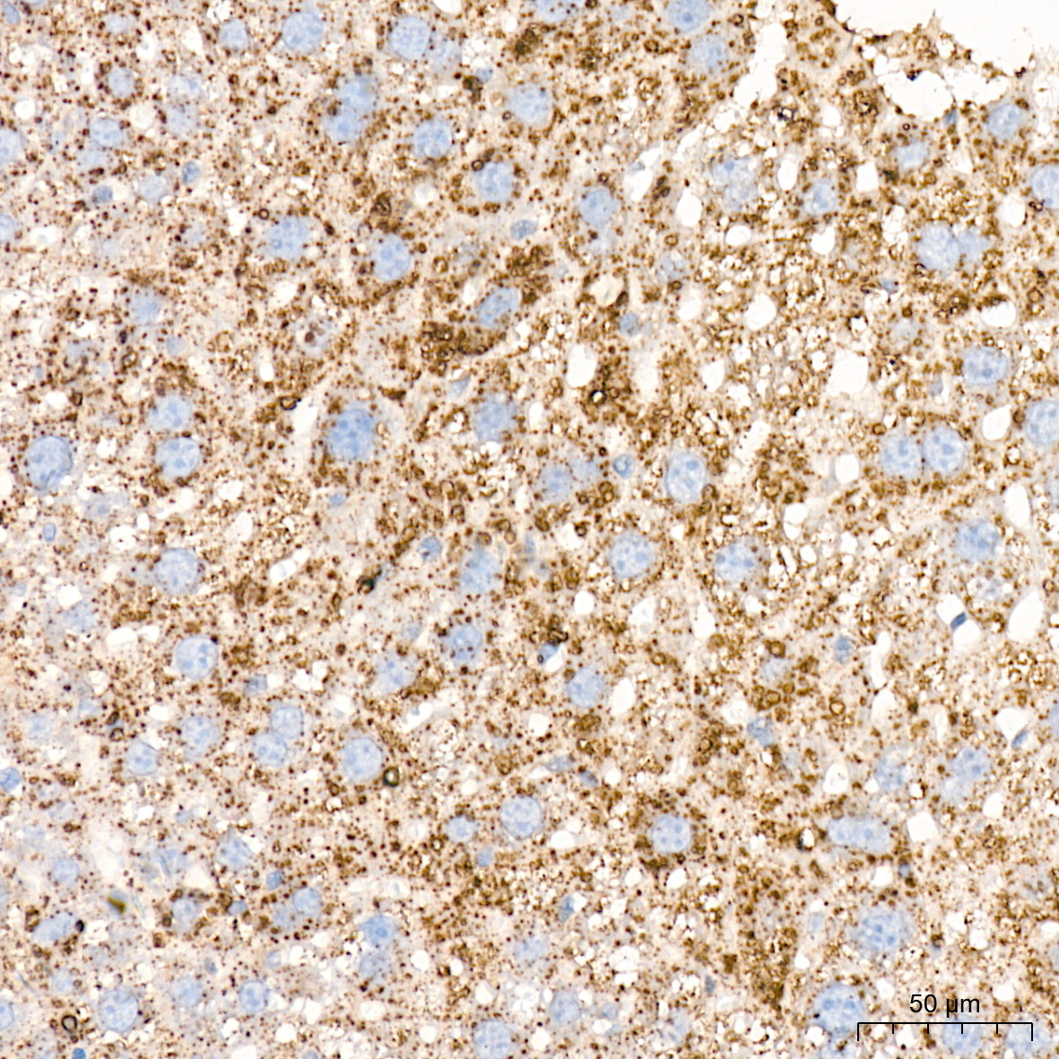 perilipin-2 Rabbit Polyclonal Antibody - Image 2