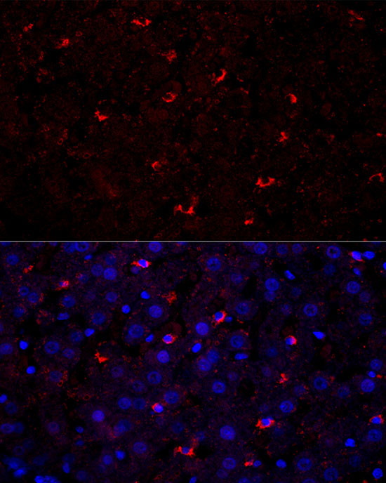 perilipin-2 Rabbit Polyclonal Antibody - Image 3