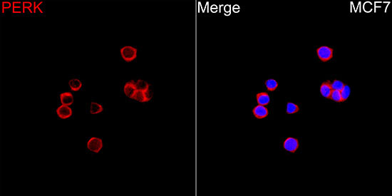 PERK Rabbit Polyclonal Antibody