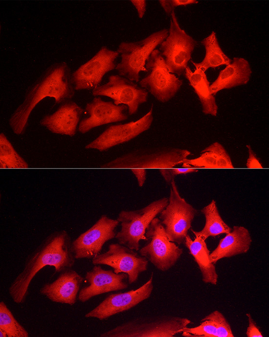 Peroxiredoxin 1/PAG Rabbit Polyclonal Antibody