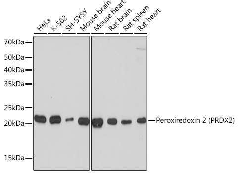 Peroxiredoxin 2 (PRDX2) Rabbit Monoclonal Antibody
