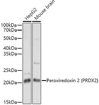 Peroxiredoxin 2 (PRDX2) Rabbit Polyclonal Antibody