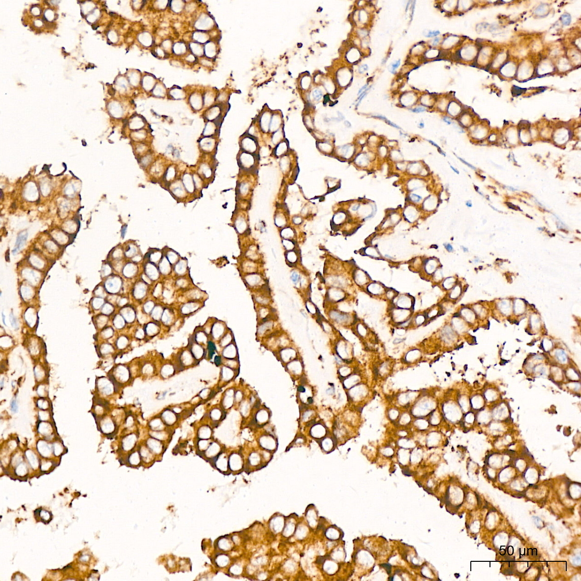 Peroxiredoxin 4 (PRDX4) Rabbit Monoclonal Antibody - Image 2