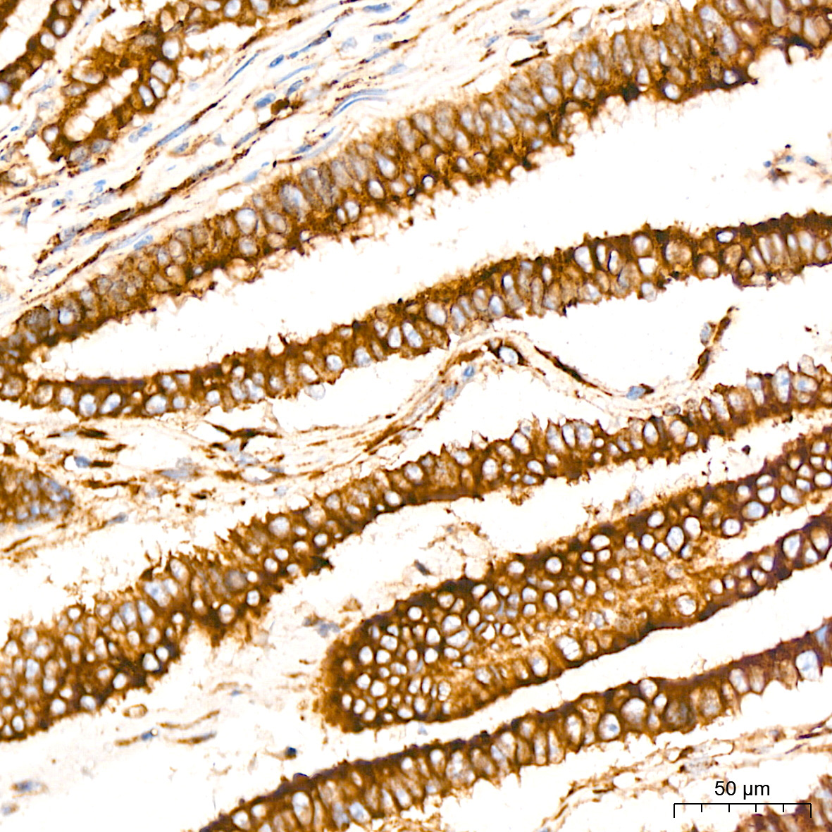 Peroxiredoxin 4 (PRDX4) Rabbit Monoclonal Antibody - Image 3