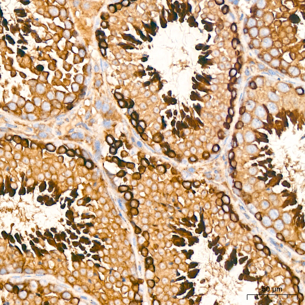 Peroxiredoxin 4 (PRDX4) Rabbit Monoclonal Antibody - Image 4